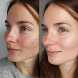 Skinola - Magic Match Foundation